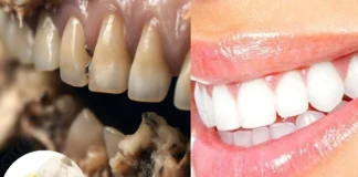 Teeth Whitening: पीले होकर सड़ चुके दांतों को लहसुन के इस खास पेस्ट से चमकाएं, बदबू-गंदगी और पीलेपन से झटपट मिलेगी राहत Teeth Cleaning