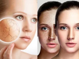 Winter Skin Care Tips