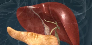 Fatty Liver: बिना दवाई के फैटी लिवर को कैसे करें ठीक? डॉक्टर से जानें Fatty Liver