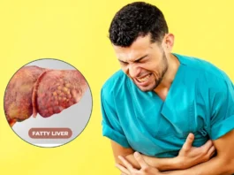 Fatty Liver