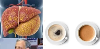 Liver के लिए चाय या कॉफी क्या है बेस्ट? लिवर के एक्सपर्ट डॉ. सरीन से जानें Liver