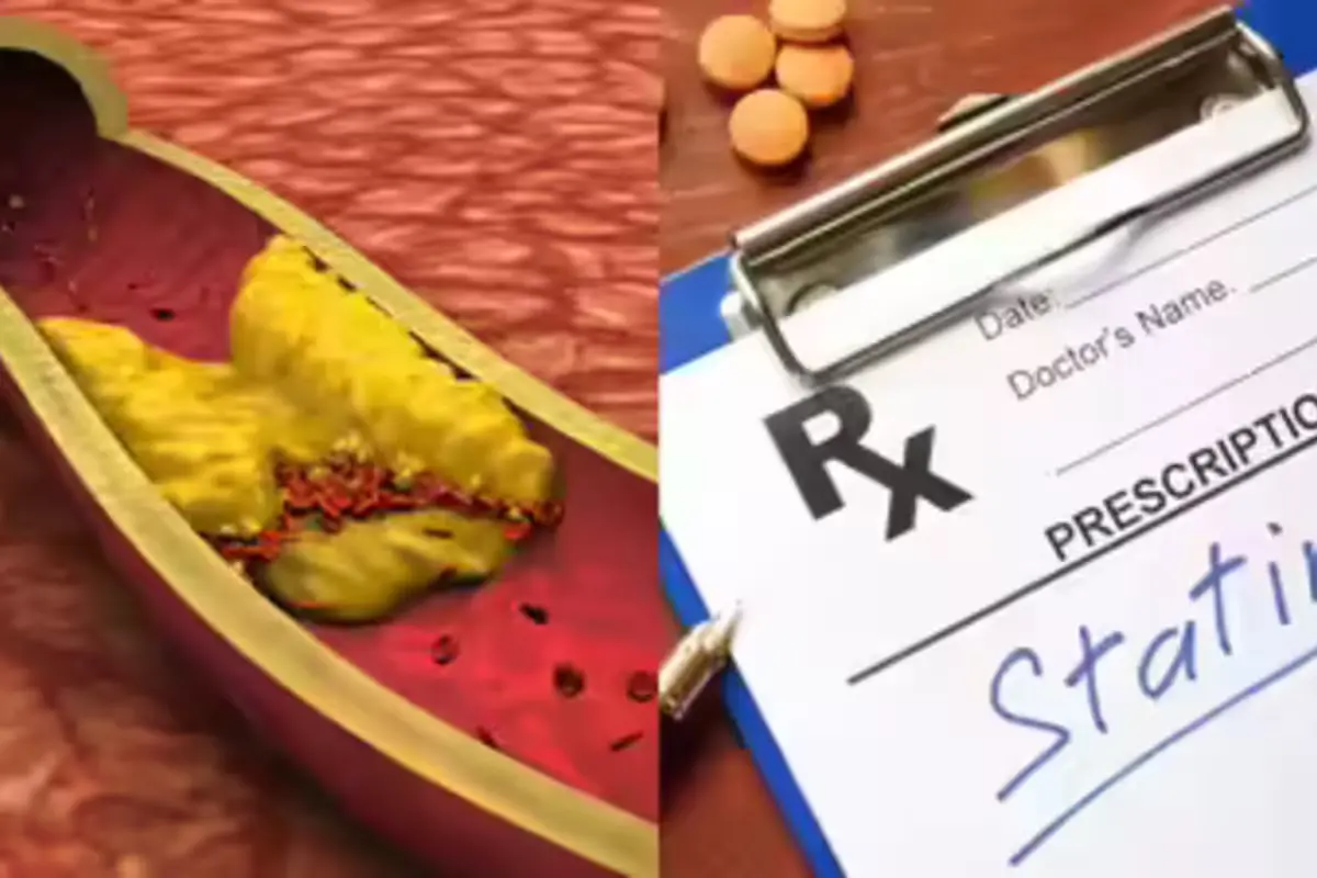 Cholesterol Reducing Foods Cholesterol Reducing Foods