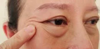 Puffy Eyes: सुबह अब सूजी हुई आंखें नहीं बिगाड़ेगी खूबसूरती, डॉक्टर से जाने घरेलू रामबाण इलाज Puffy Eyes