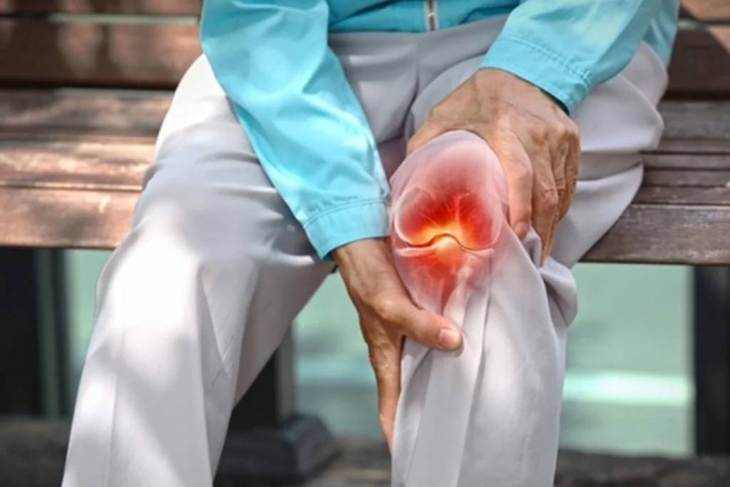 Arthritis Treatment