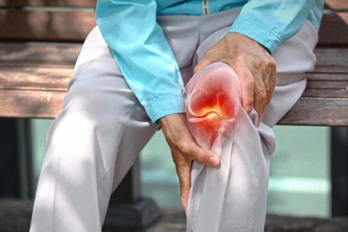 Arthritis Treatment