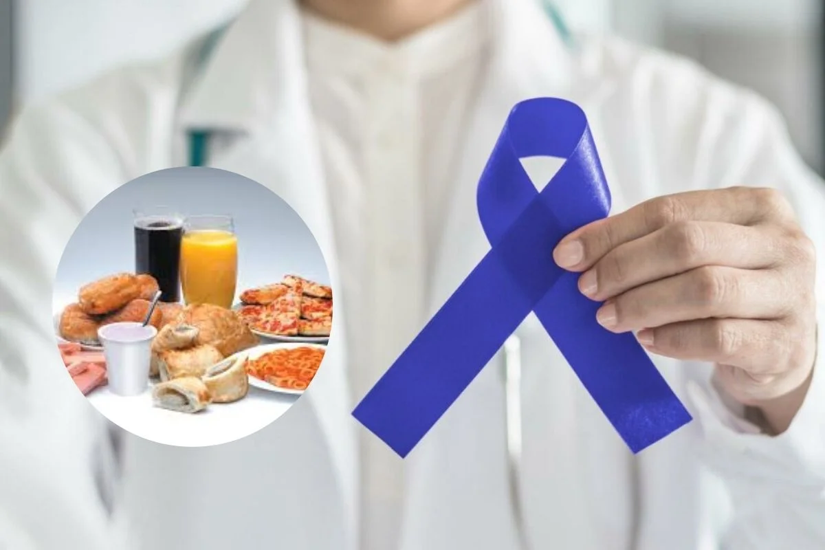 Colorectal Cancer