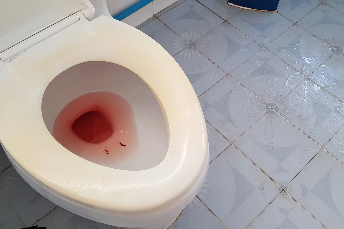 Blood in Urine