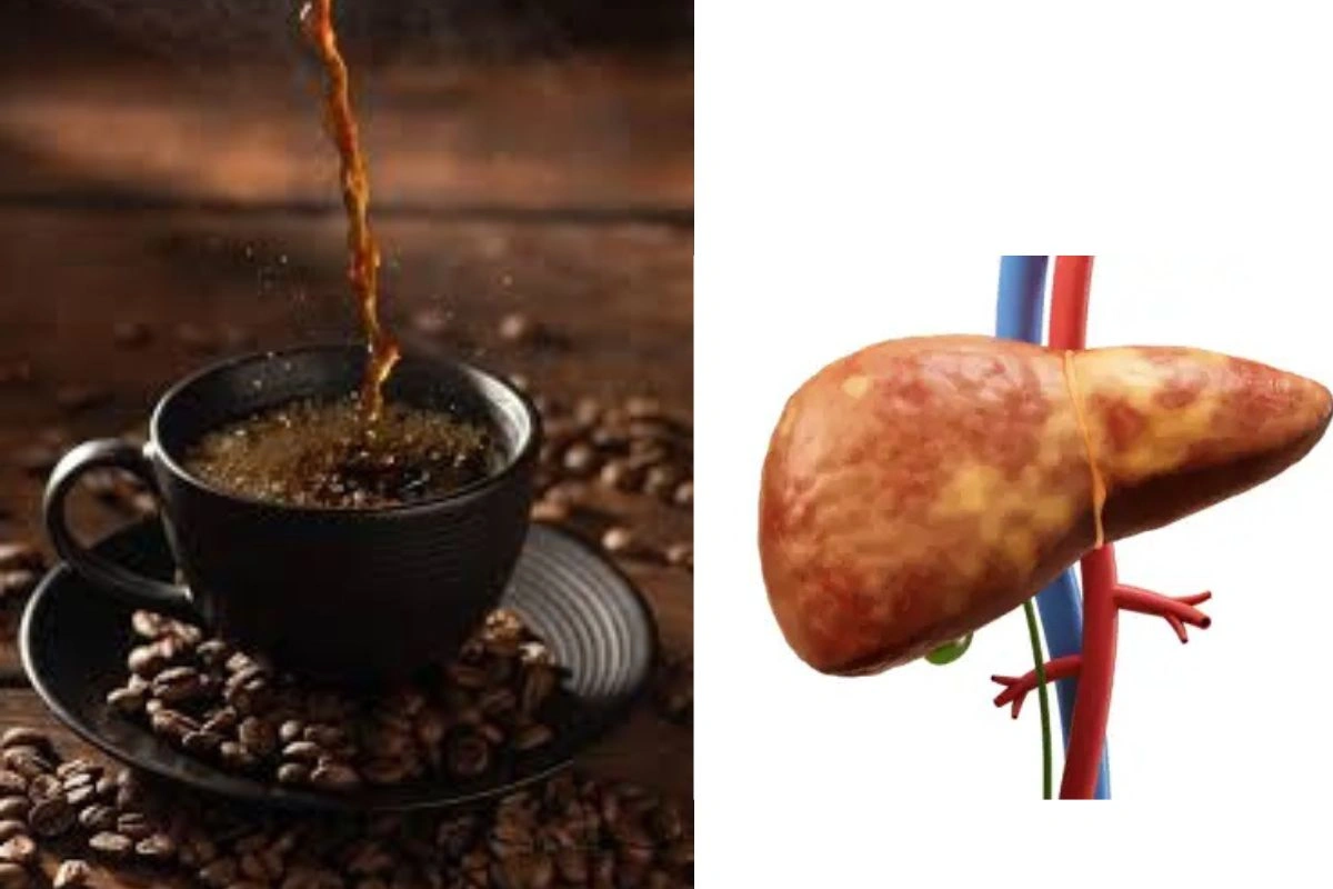 Fatty Liver