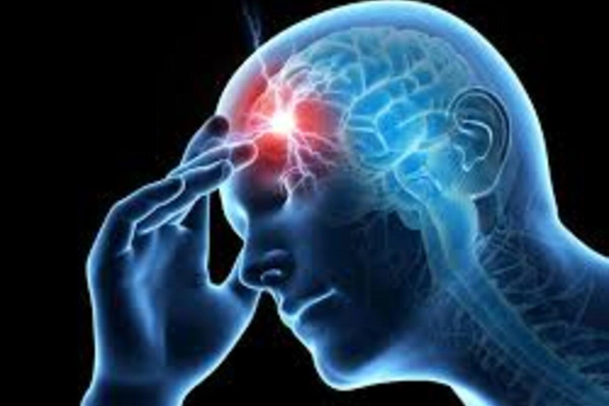 Migraine Treatment