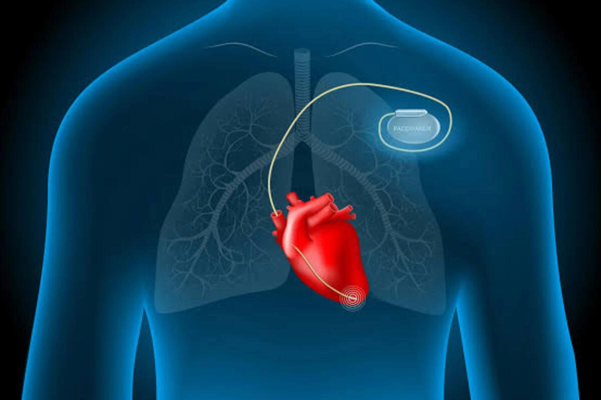 Heart Health