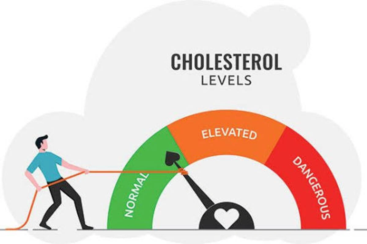 Cholesterol Reduce
