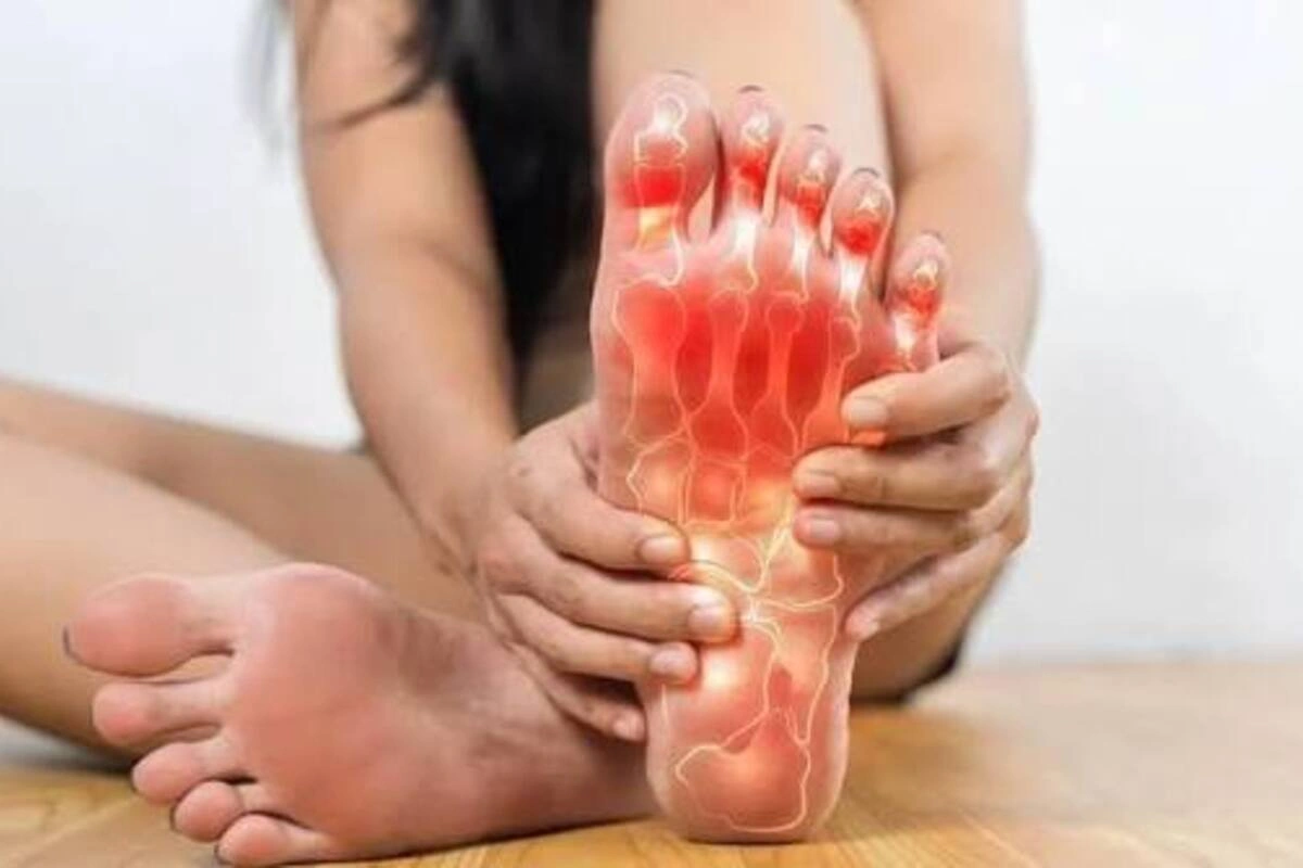 Uric Acid